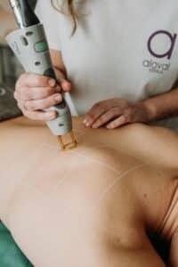 bonos depilación láser alejandrita