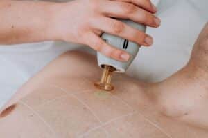 bonos depilación láser alejandrita